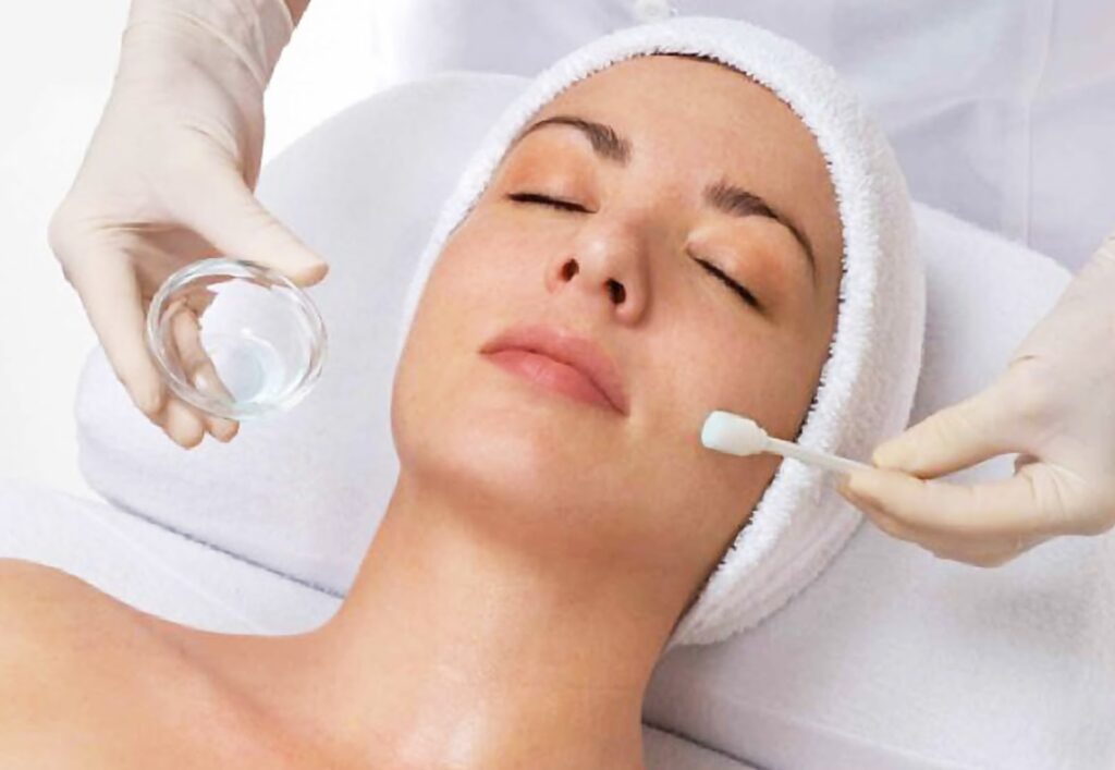 How To Know Which Peels Treatment Is Right For Your Skin?